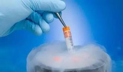体外受精 IVF-ET